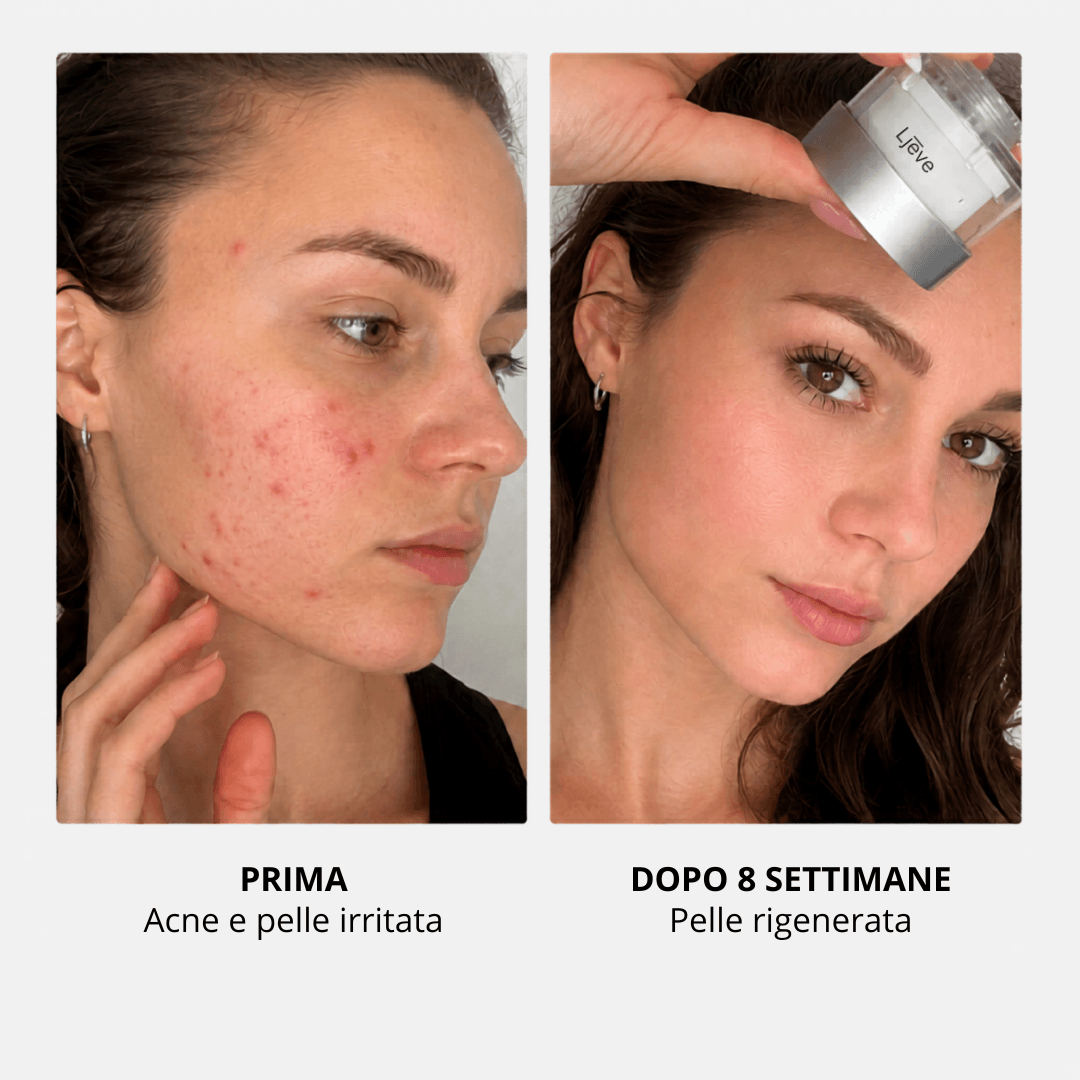 Filtro Ljēve™ rubinetto
