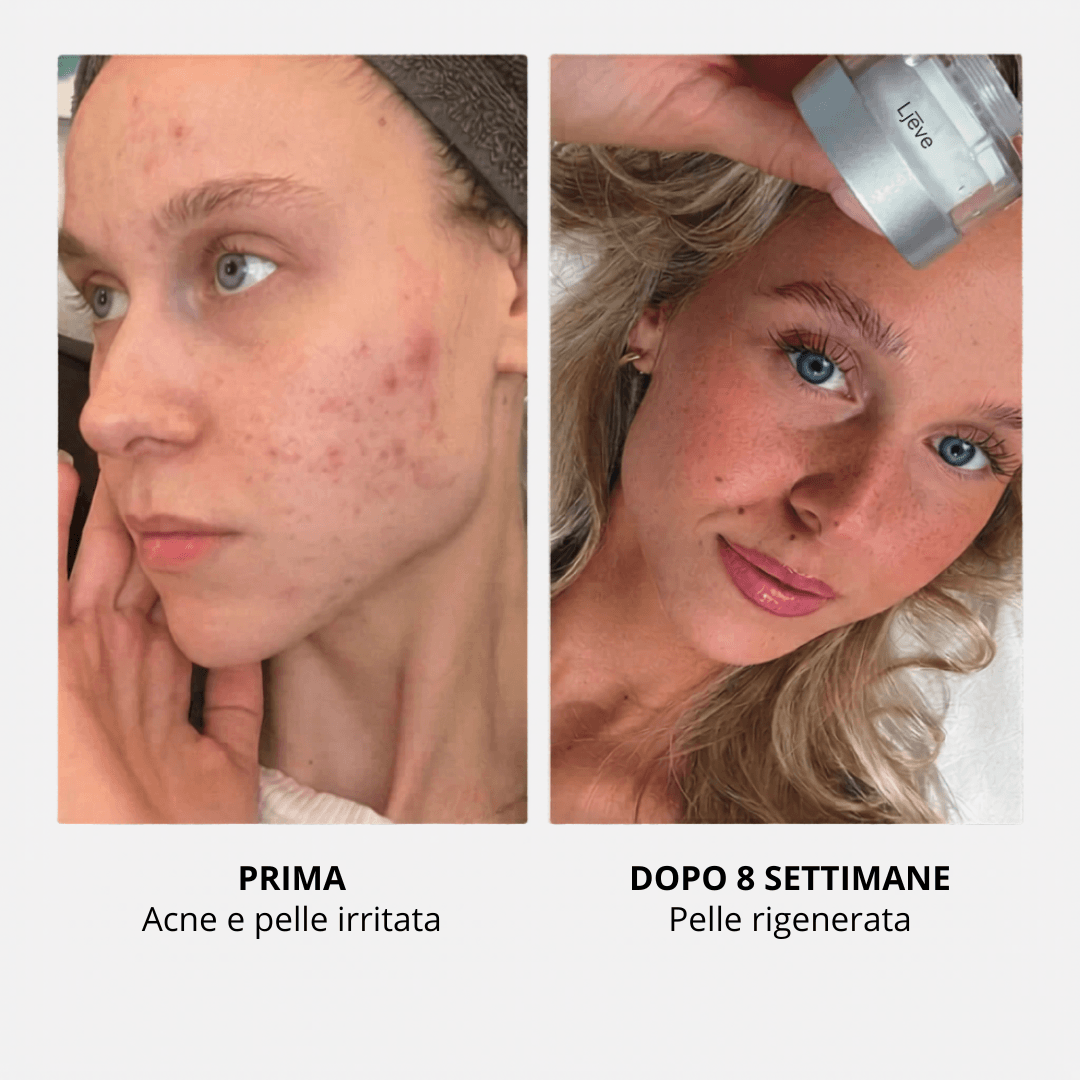 Filtro Ljēve™ rubinetto